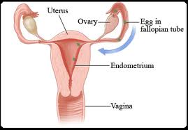 Endometriosis dan zuriat